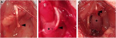 Effects of regenerative peripheral nerve interface on dorsal root ganglia neurons following peripheral axotomy